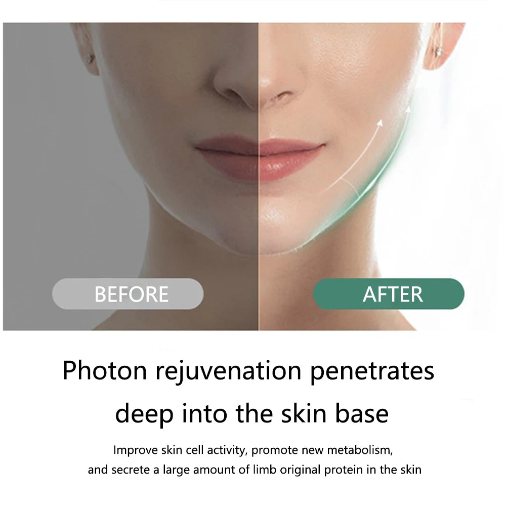 Facial Massager - Beauty Creation..